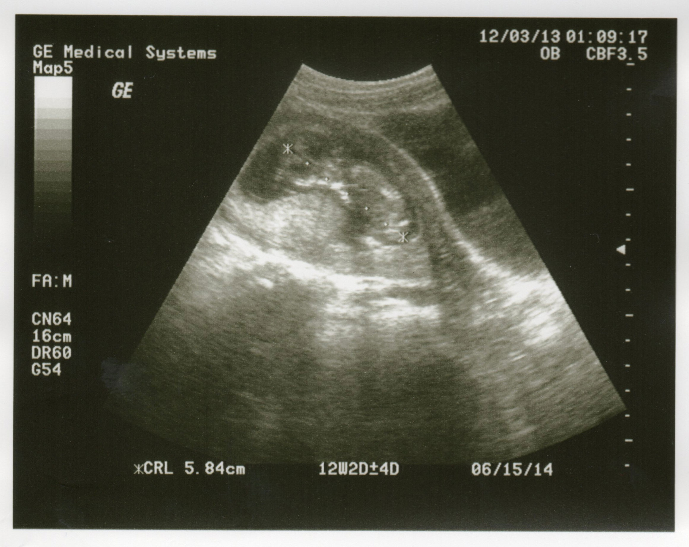 12 Week Ultrasound on December 12, 2013